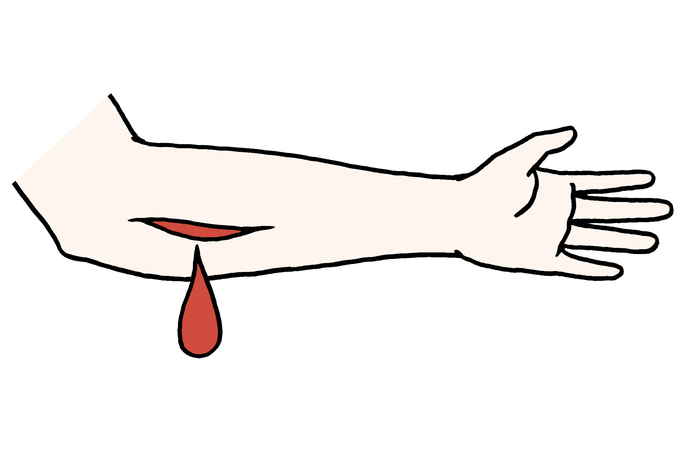 Illustration: Aus einer Wunde am Unterarm tritt Blut aus.