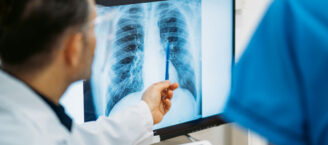 Ein Arzt in weißem Kittel zeigt mit einem Kugelschreiber auf ein Röntgenbild, das einen Teil der Lunge zeigt.